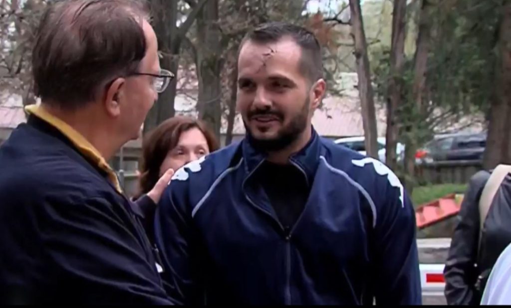First Kocani Fire Patient that Received Treatment abroad Returns to North Macedonia