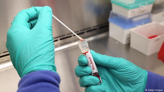 Public Health Institute Registers Two Mpox Cases